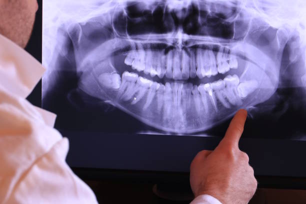 Best Chipped Tooth Repair Near Me  in Summerfield, MD