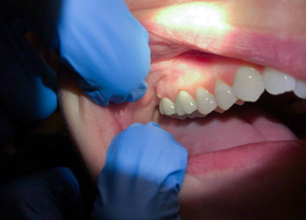 Best Dentist Open Late Near Me  in Summerfield, MD